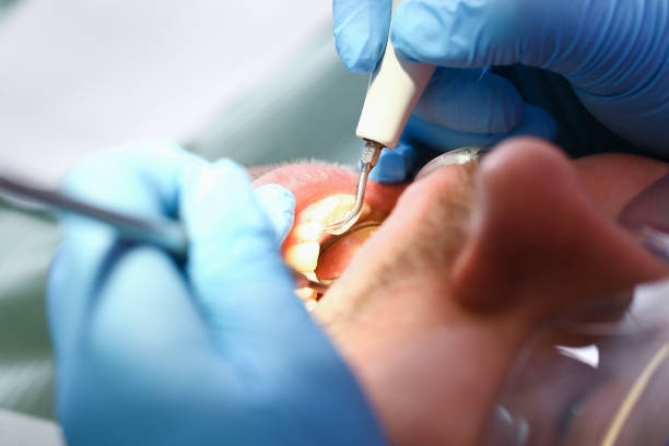 Best Broken or Cracked Tooth Emergency Dentist in Coson, OK