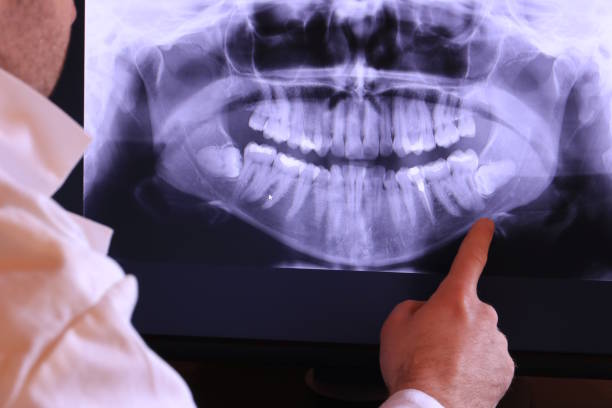 Best 24-Hour Emergency Dentist in Coson, OK